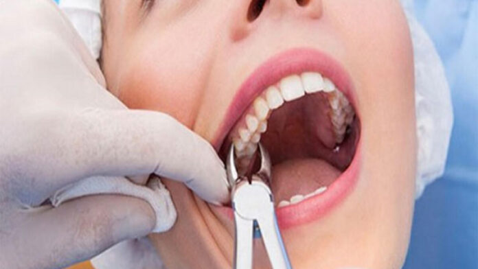 Diş Ağrısı Nasıl Geçer