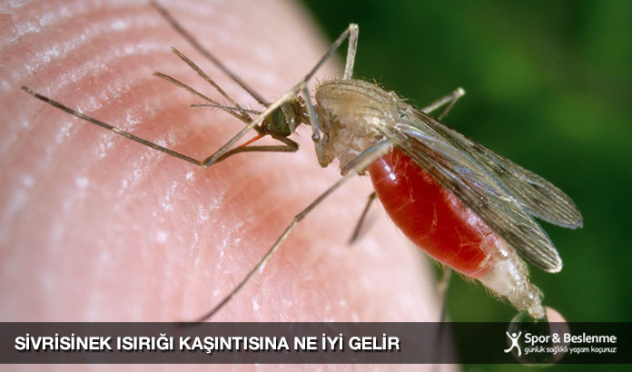 sivrisinek ısırığı kaşıntısına ne iyi gelir