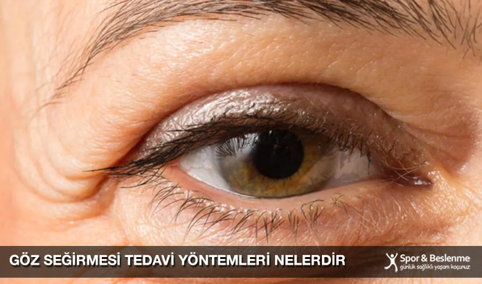 Göz Seğirmesi Tedavi Yöntemleri Nelerdir