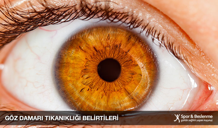 göz damarı tıkanıklığı belirtileri nedir